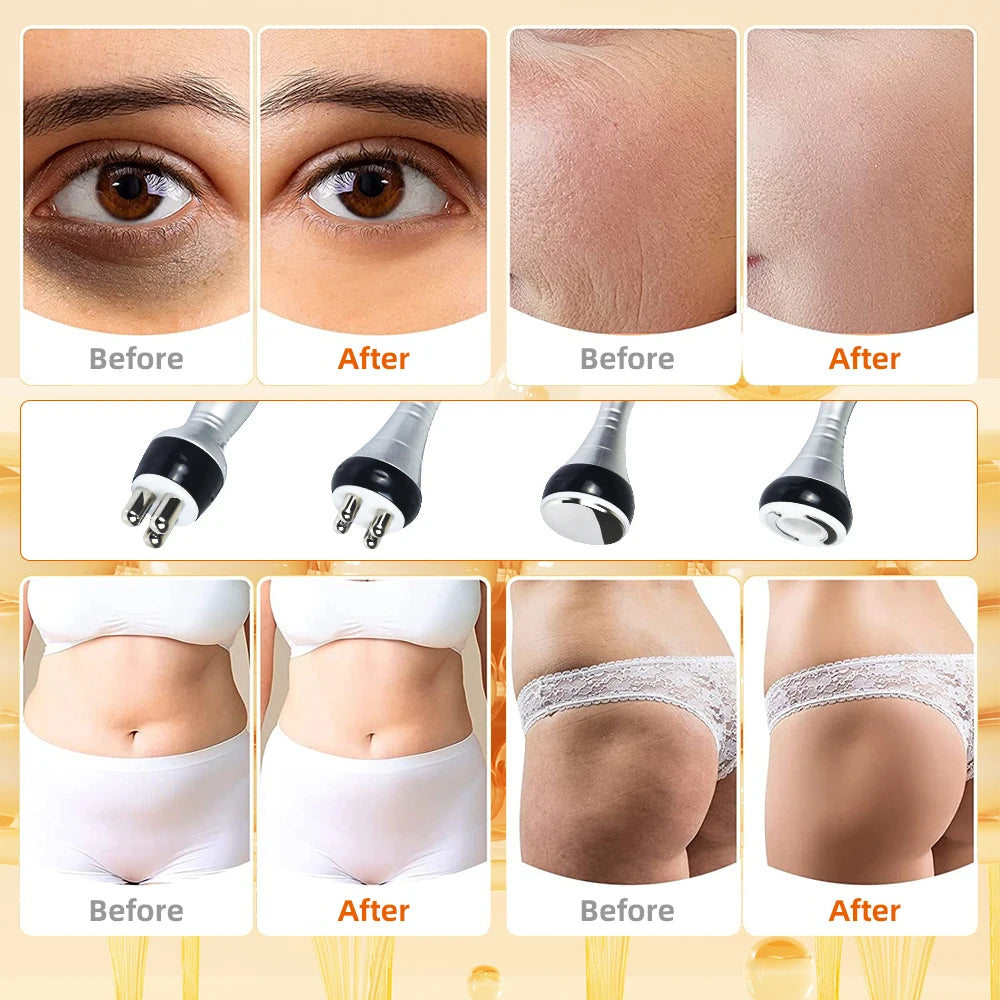 Biteezy 4IN1 Body Slimming