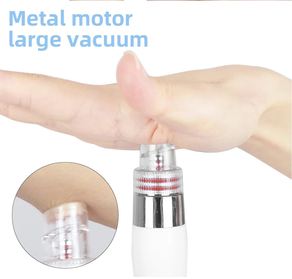 Biteezy-Bubble 7-in-1 Facial Spa: Deep Clean + O₂ Infusion + Diamond Peeling
