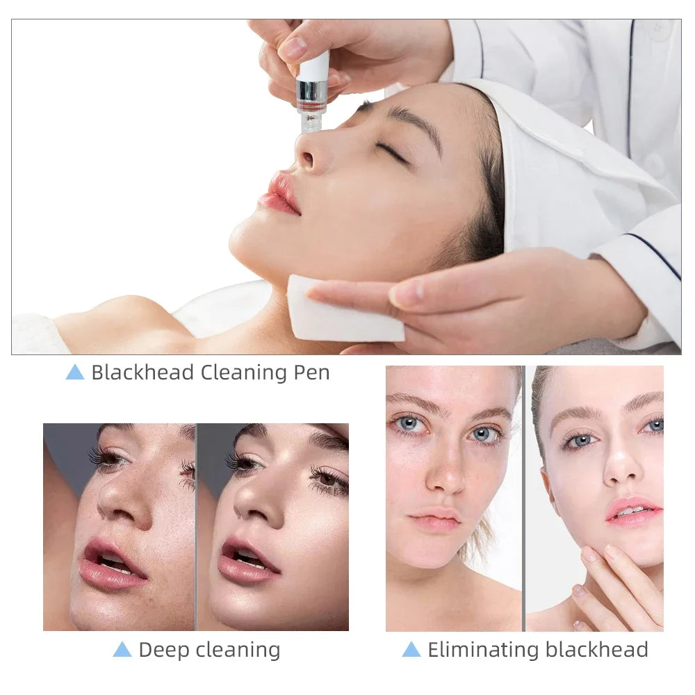 Biteezy-Bubble 7-in-1 Facial Spa: Deep Clean + O₂ Infusion + Diamond Peeling