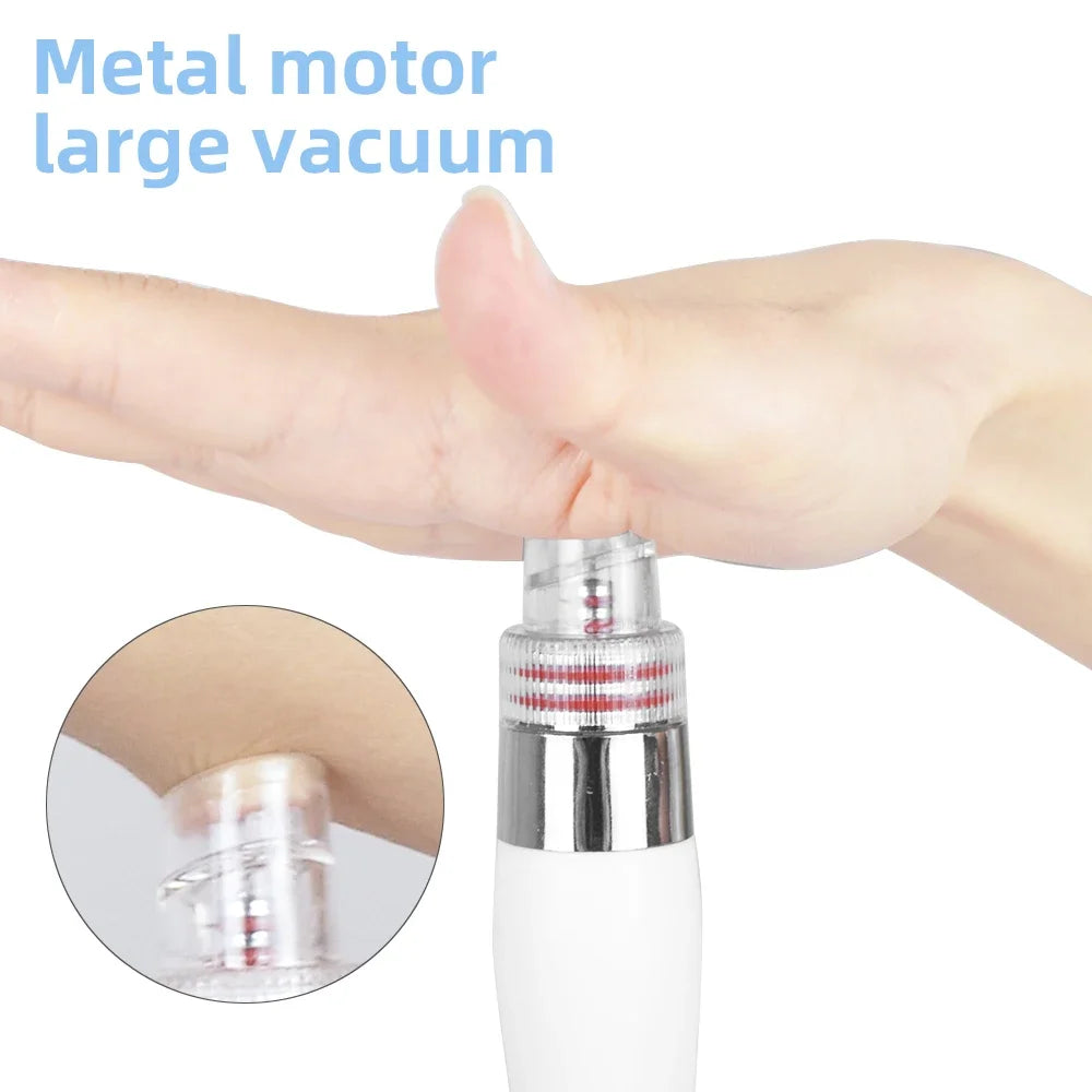 Biteezy-Bubble 7-in-1 Facial Spa: Deep Clean + O₂ Infusion + Diamond Peeling