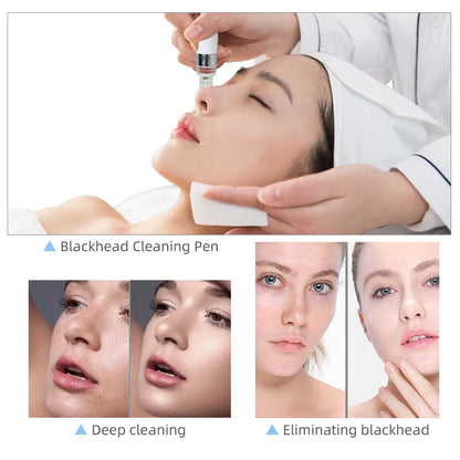 Biteezy-Bubble 7-in-1 Facial Spa: Deep Clean + O₂ Infusion + Diamond Peeling